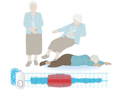 1-01 Graphic depicting what happens when the Auto Alert button detects a fall after the 30 second grace period.